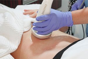 هزینه لاغری با دستگاه rf